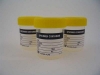 SPECIMEN CONT YELLOW LID 70ml - Click for more info